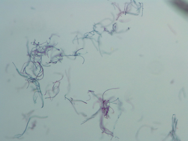 Anabaena Slides - Anabaena 03 100X